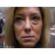 Instantly Ageless di jeunesse, lifting immediato,  5 fiale